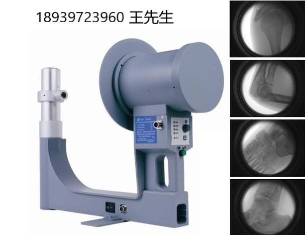骨科便携式x光机透视仪骨科x射线机